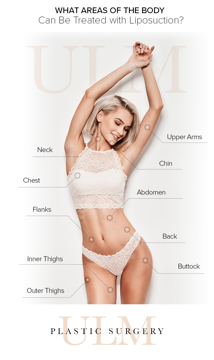 Las Vegas Body Contouring