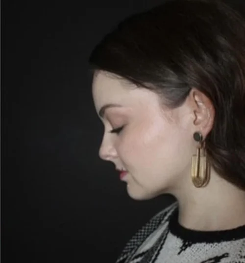 Submental Liposuction Before and After Gallery